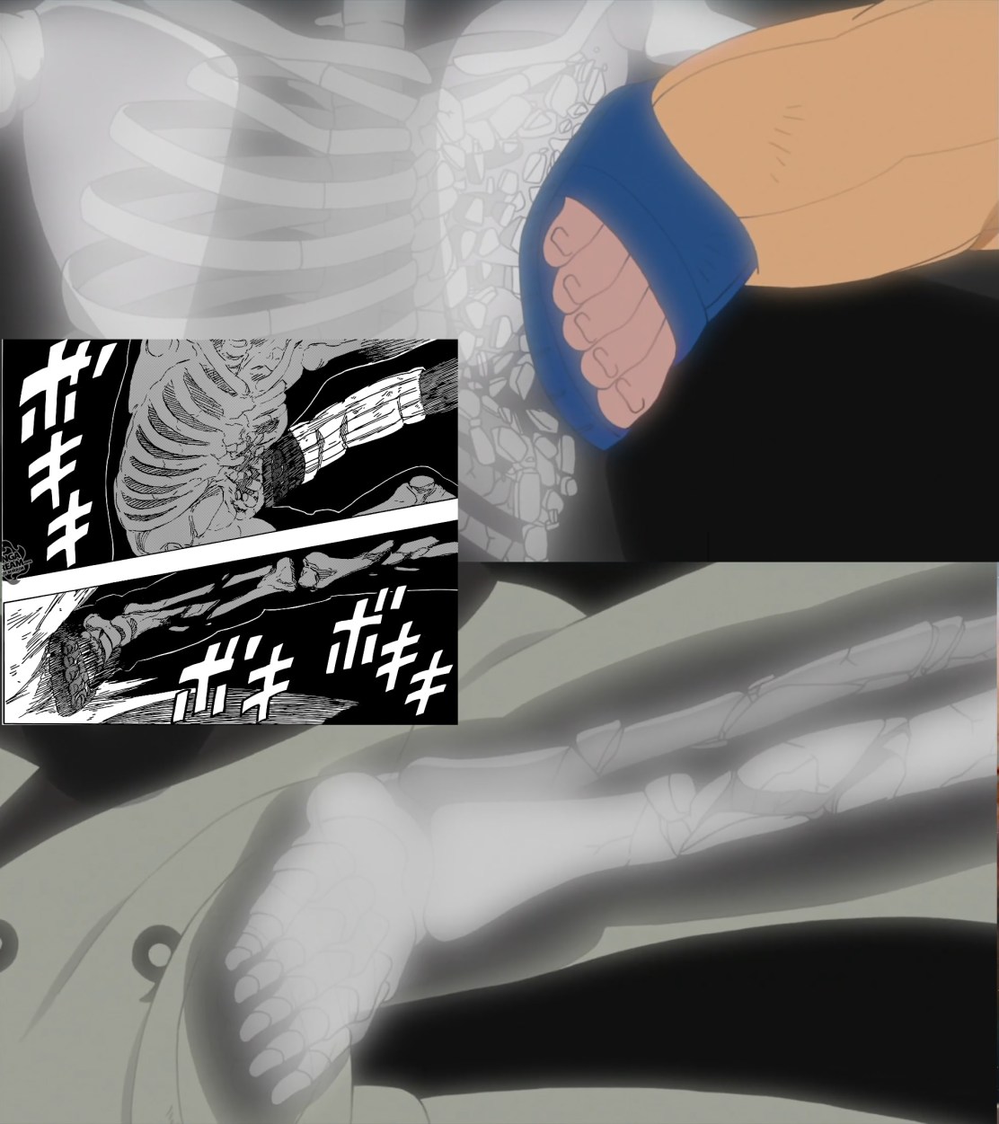 34 - BONES ARE SHATTERING